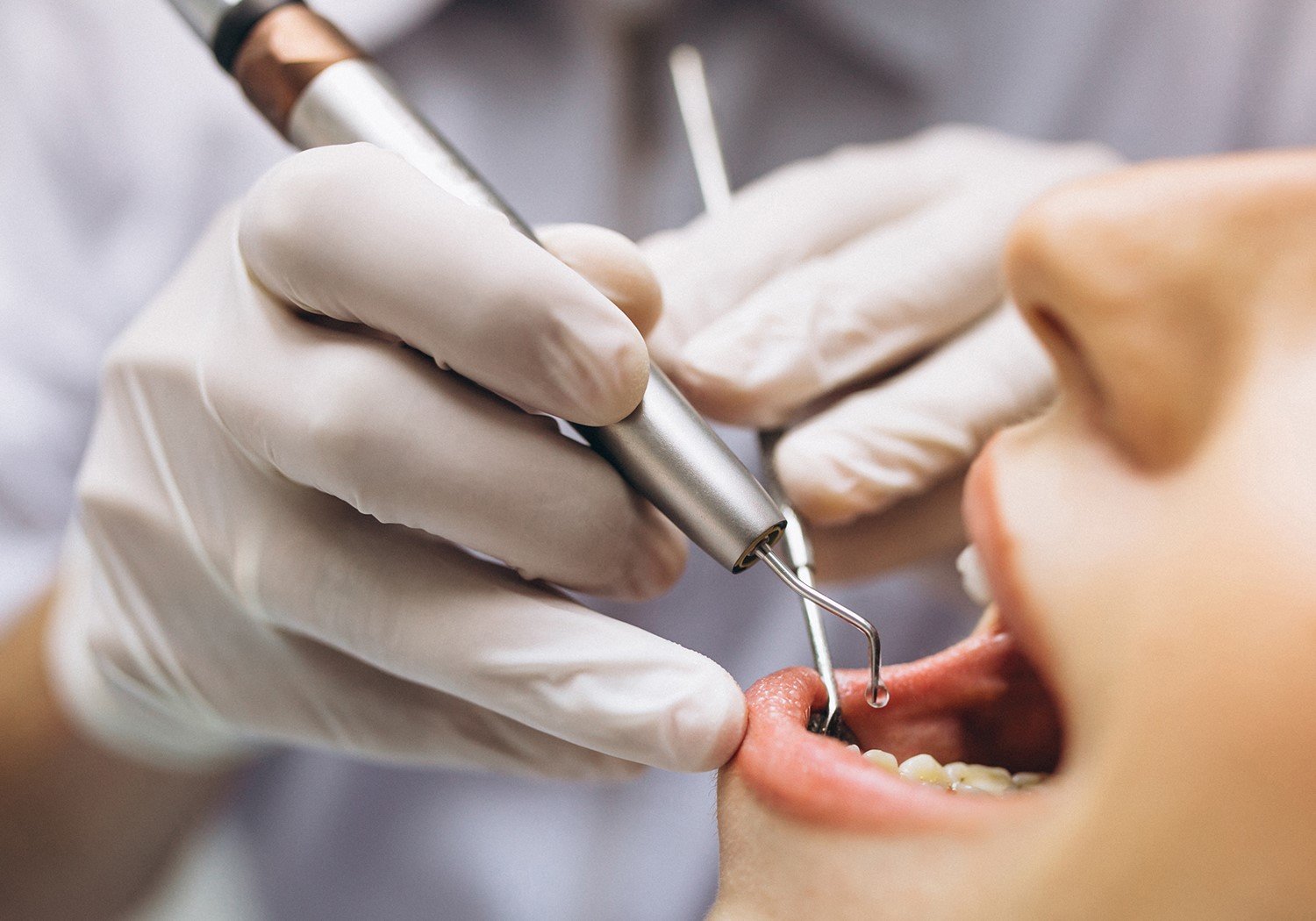 Dental Instruments